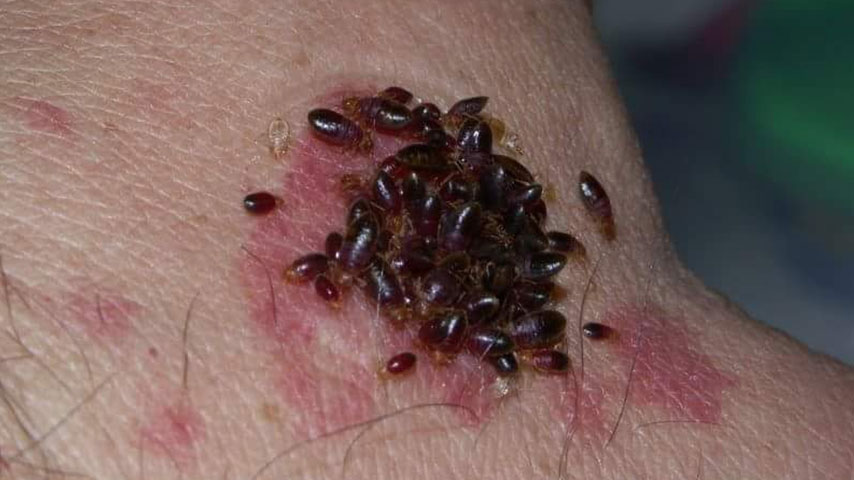 bed bugs singapore