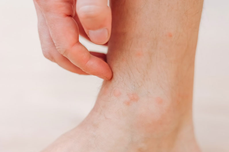 close-up-man-scratching-with-hand